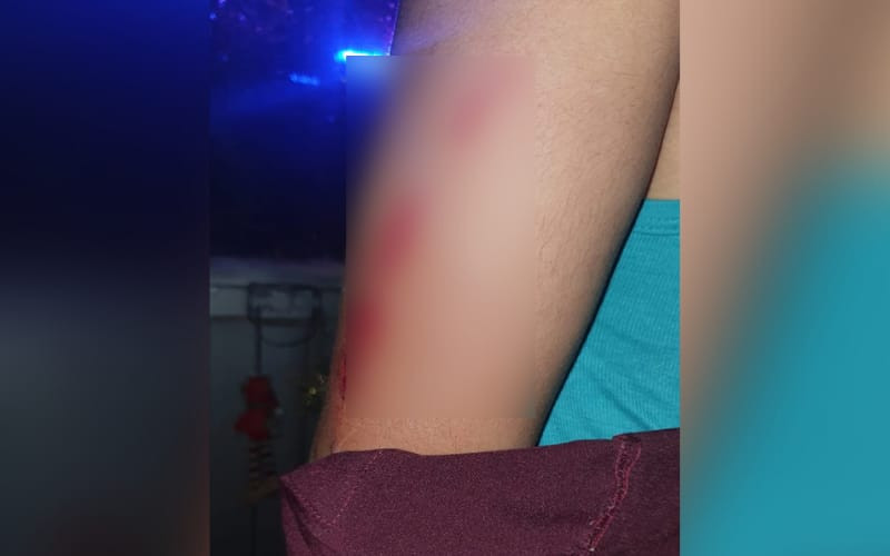 Un herido en intento de robo en Bucaramanga