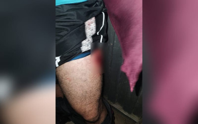 Un herido en intento de robo en Bucaramanga