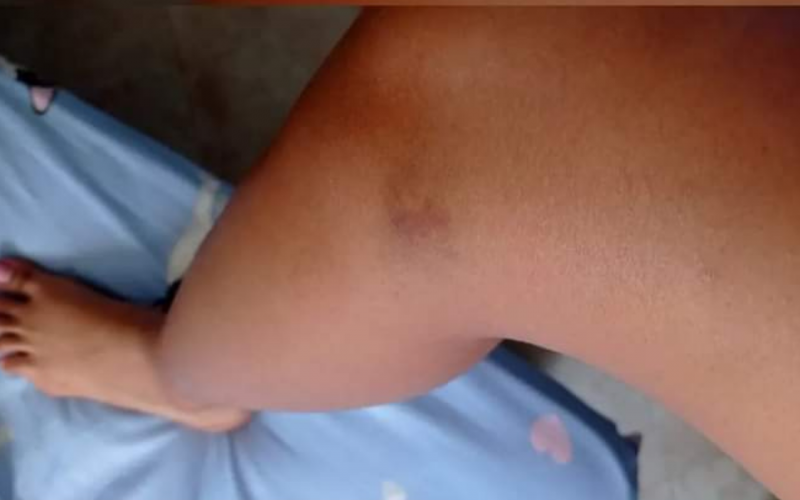 Joven denunció por violencia a su expareja, un fotógrafo de Bucaramanga