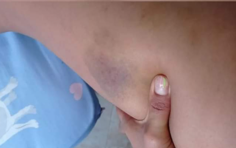 Joven denunció por violencia a su expareja, un fotógrafo de Bucaramanga