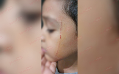 Madre denuncia bullying a su hijo en colegio de Piedecuesta