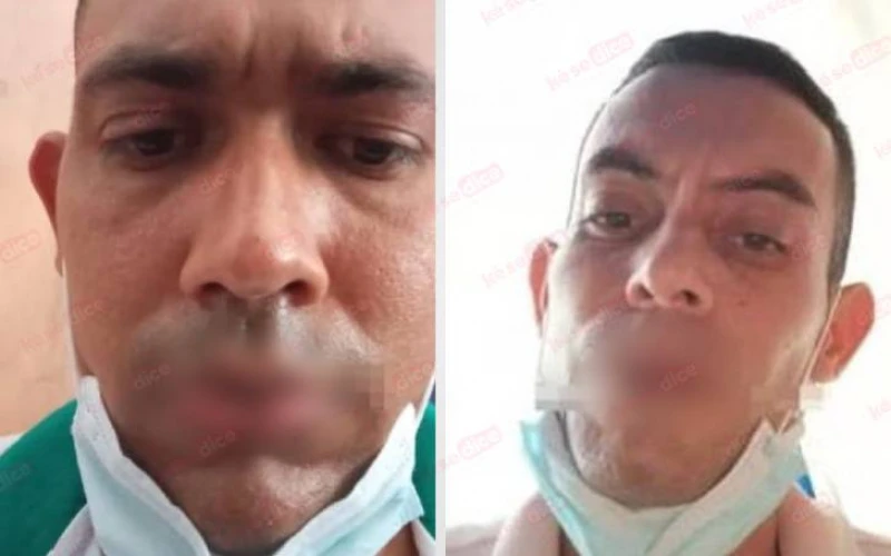 ¡Desesperación en Palogordo! Presos se cosen la boca para exigir su traslado