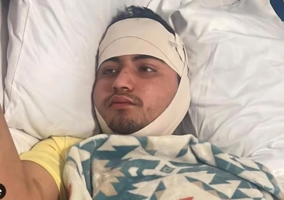 Familia en Bucaramanga pide ayuda para joven que se accidentó en Estados Unidos